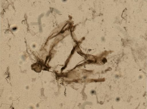 Victorella muelleri