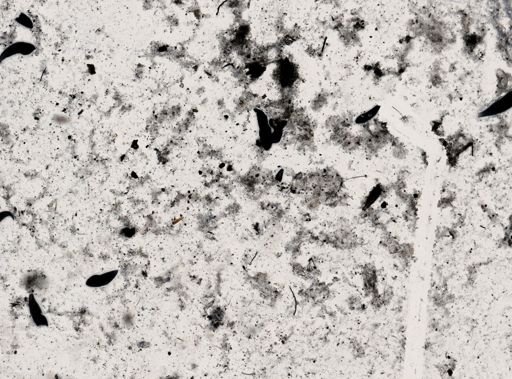 Trichomonas