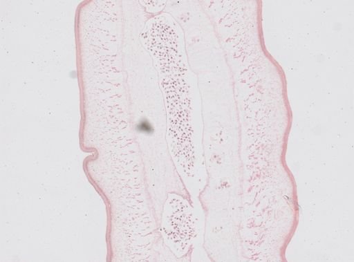 Taenia saginata
