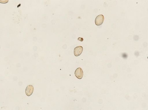 Paragonimus westermani