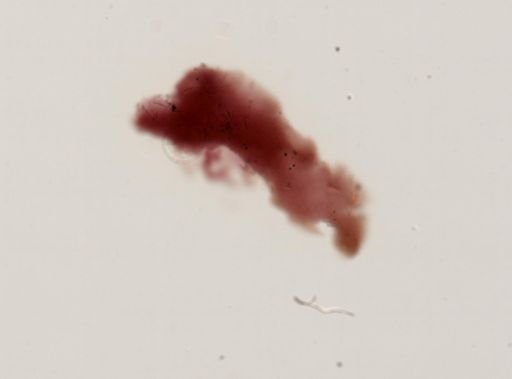 Halisarca sp.