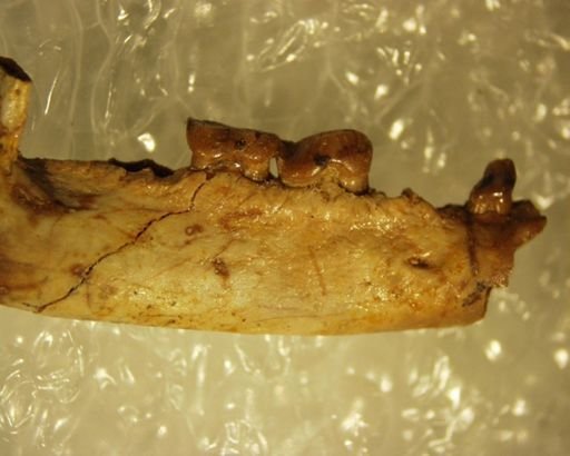 Adapisoricidae sp.