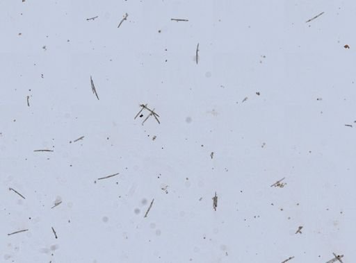 Trochospongilla pennsylvanica