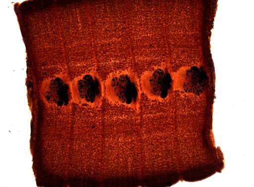 Diphyllobothrium erinacei