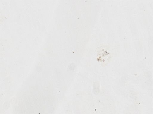Paramecium