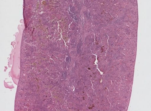 Leishmania donovani