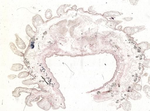 Thysanozoon brocchii