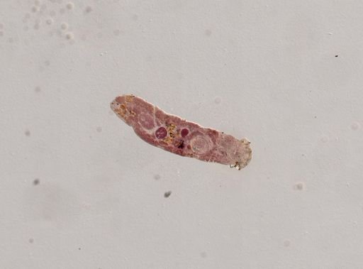 Crepidostomum