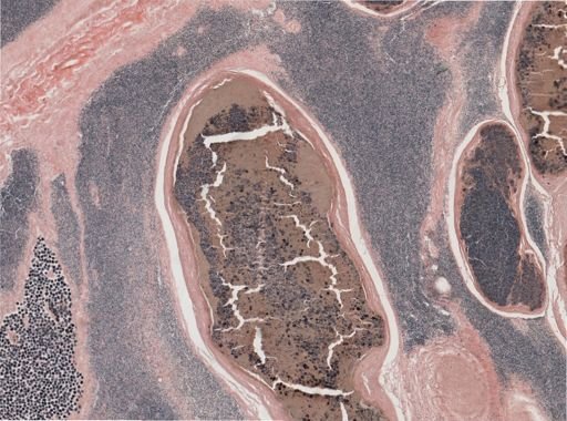 Ichthyosporidium