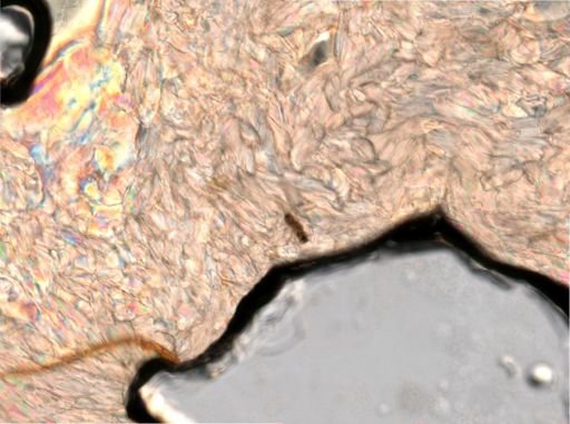Trichocerca insignis
