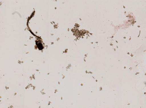 Trachelomonas