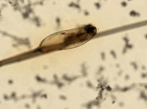 Pediculus humanus
