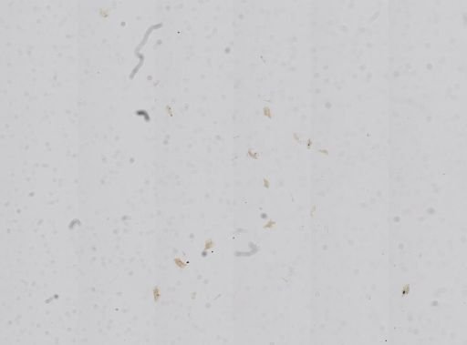 Hydrobia truncata
