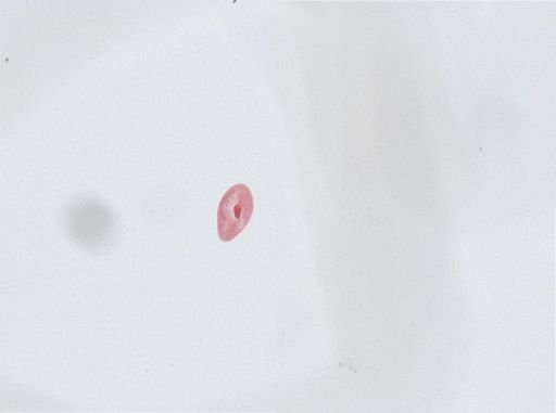 Paramecium aurelia