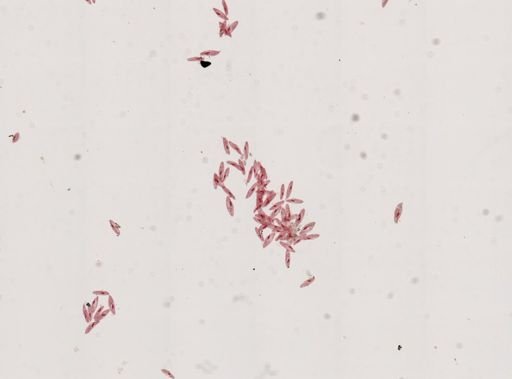 Paramecium