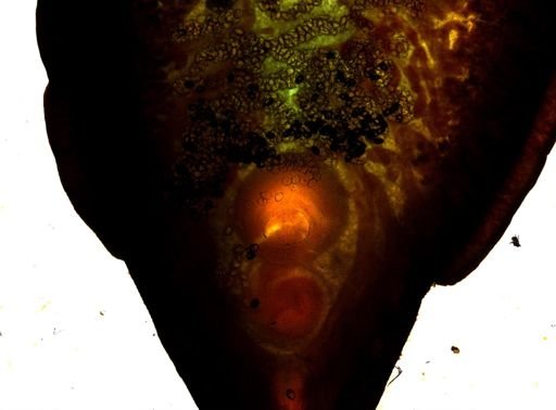 Fasciola gigantica