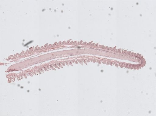 Plicatoperipatus jamaicensis