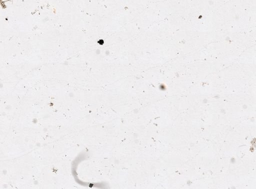 Axinella?