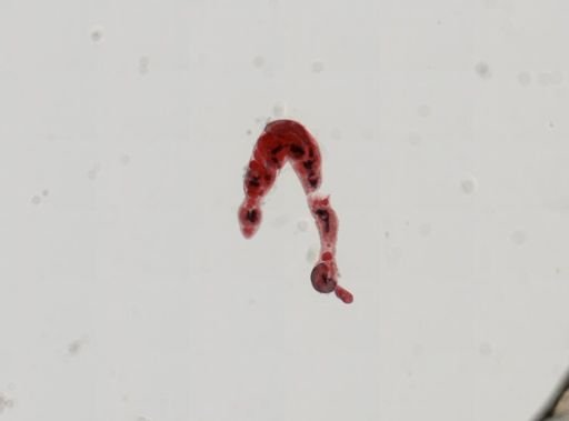 Trematoda