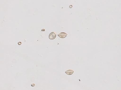 Cestoda
