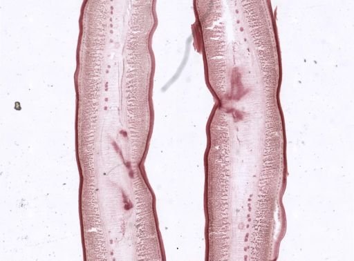 Ligula intestinalis