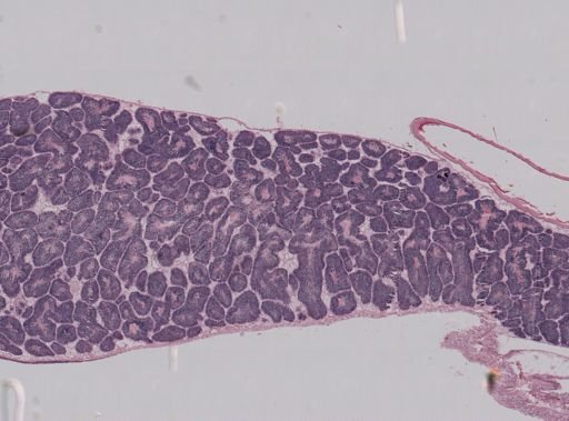 Anomia