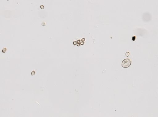 Cestoda