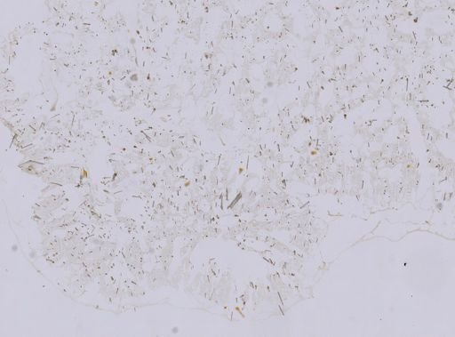 Stromatospongia vermicola
