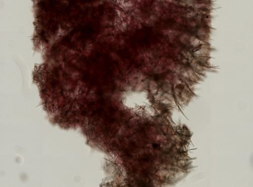 Haliclonidae