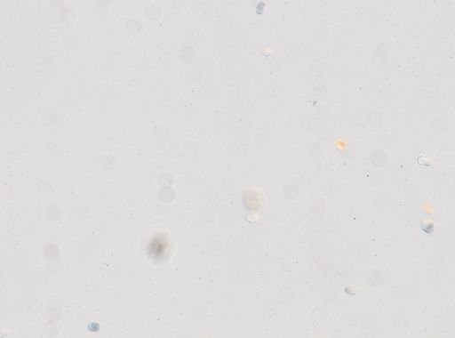 Toxocara cati