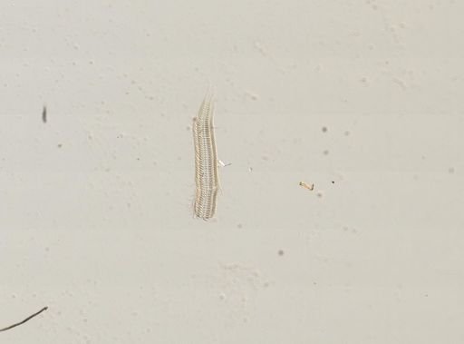Amnicola orbiculata