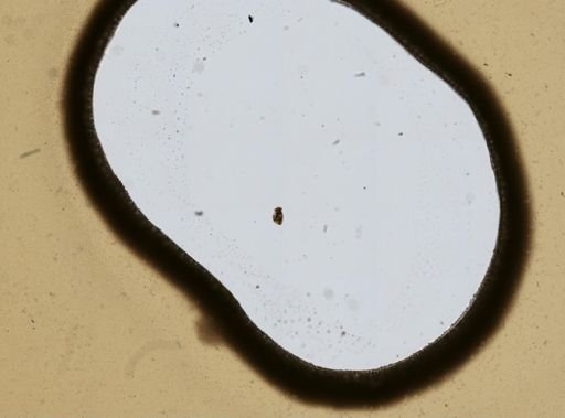 Pompholyx sulcata