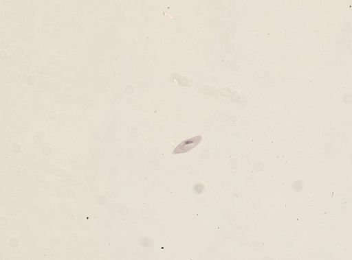 Paramecium multimicronucleatum