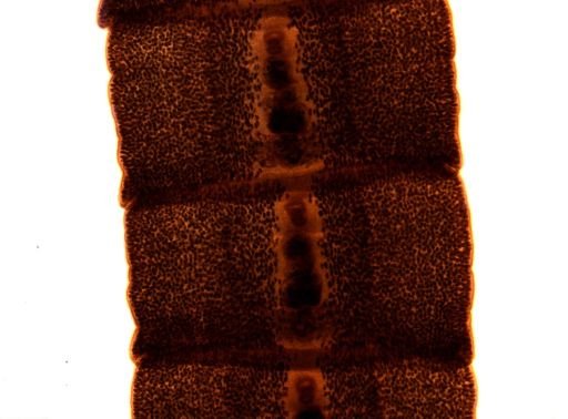 Diphyllobothrium erinacei