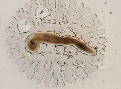 Enterobius vermicularis