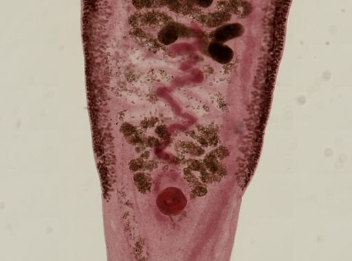 Clonorchis sinensis
