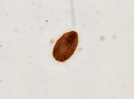 Tetracotyle?