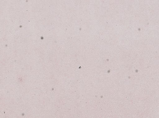 Trypanosoma equinum