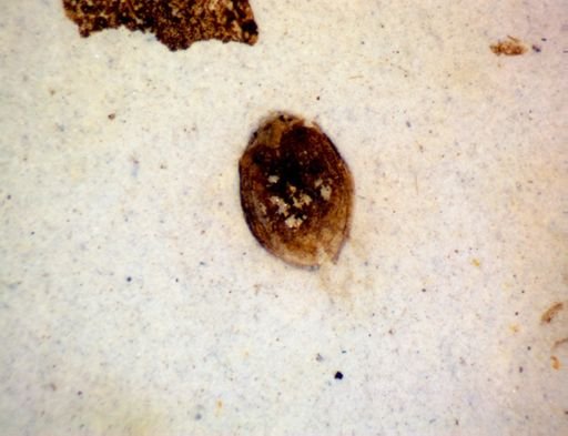 undet. Coleoptera