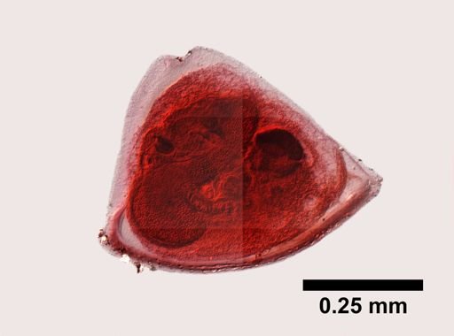 Bryozoa