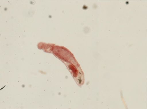 Dinophilus gyrociliatus