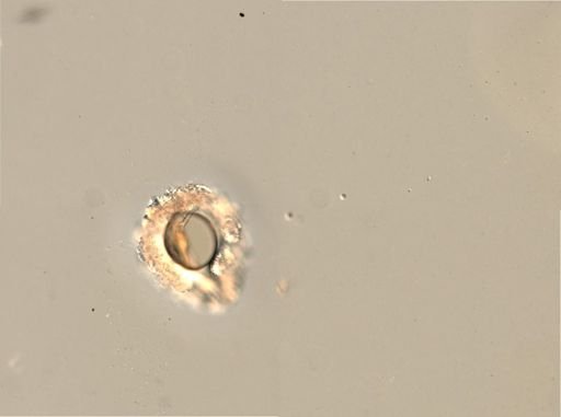 Rotifera