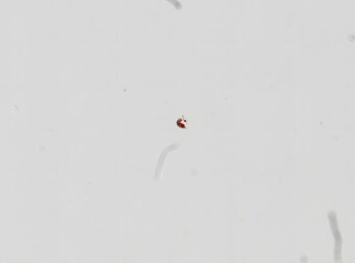 Trematoda