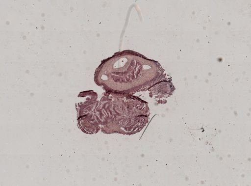 Nemertea