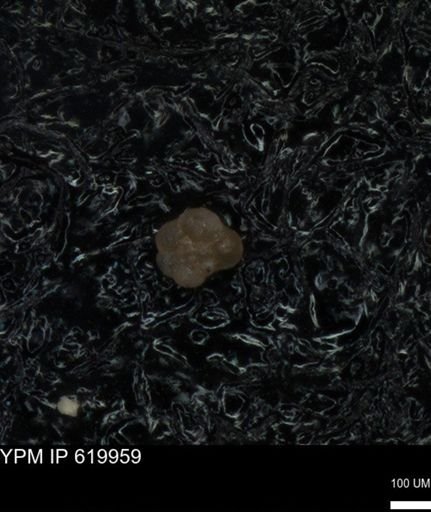 undet. Foraminiferida