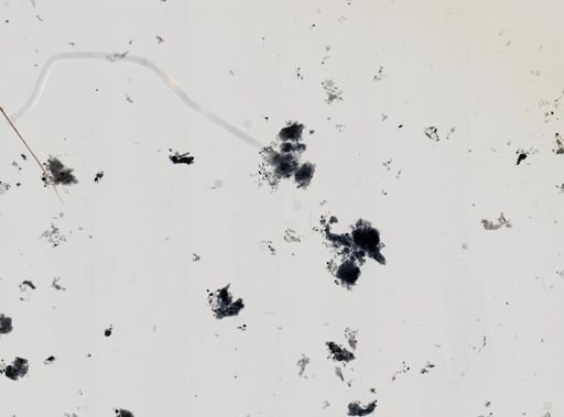 Entamoeba histolytica