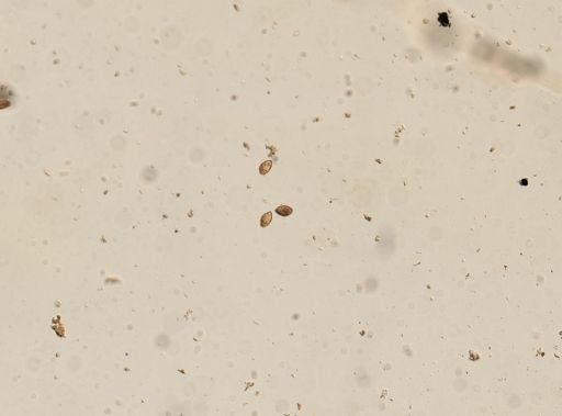 Diphyllobothrium canis