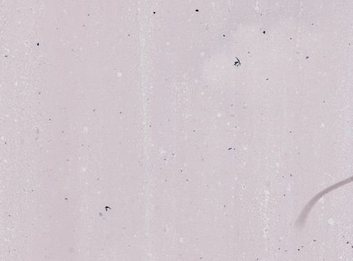 Plasmodium malariae