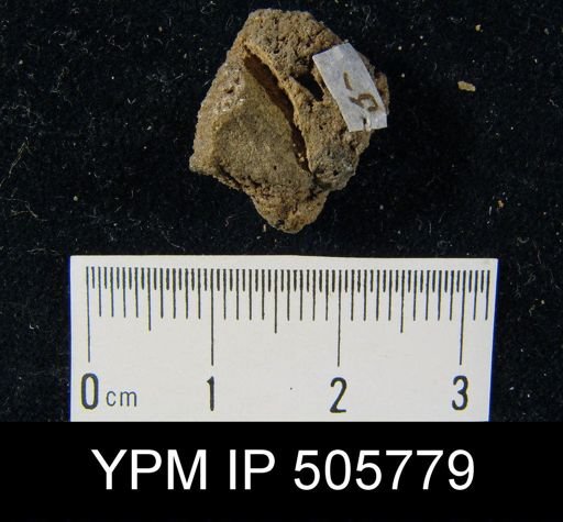 Metaplasia pyxidata