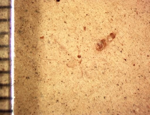 undet. Insecta